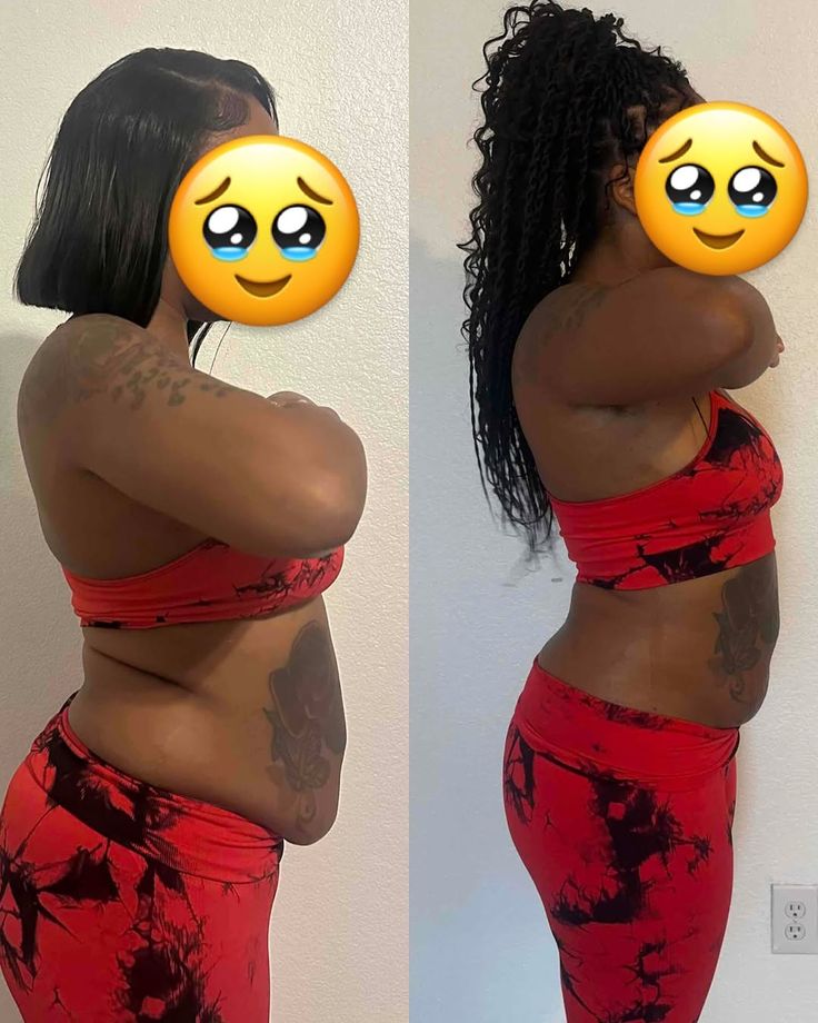 Transformação feminina - Perda de gordura lateral